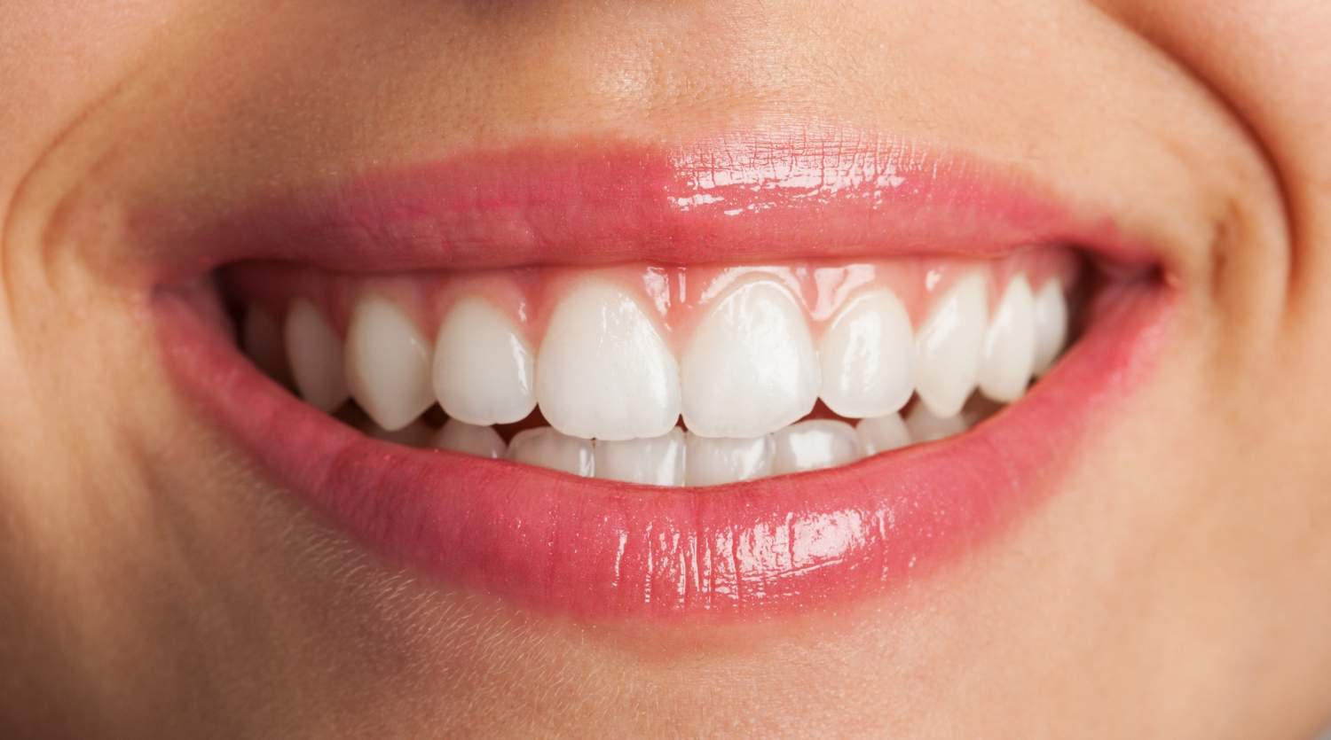 Cómo mejorar la estética de la sonrisa de forma natural