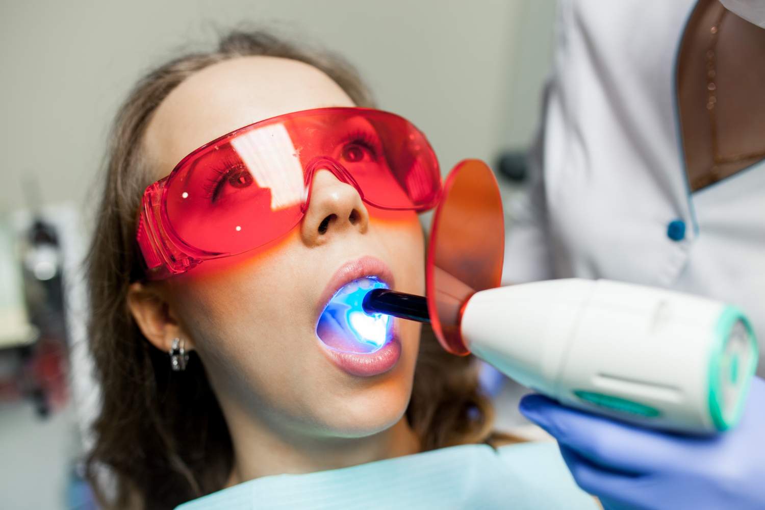 ¿Cuánto dura un blanqueamiento dental y qué cuidados necesita después?