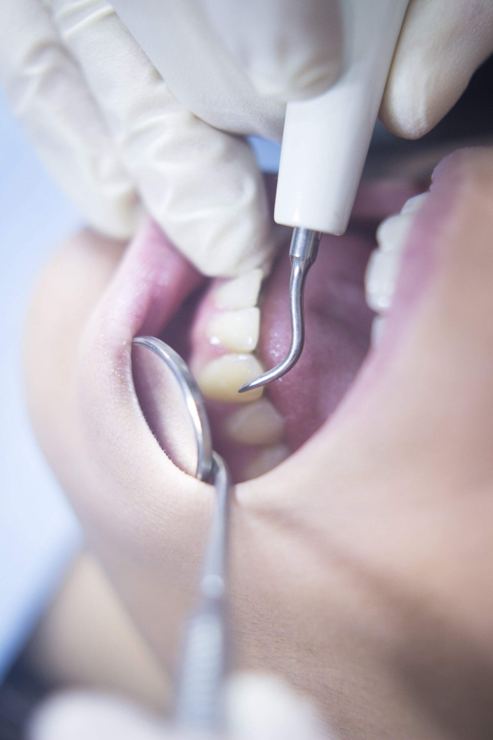 Revisión dental en consulta