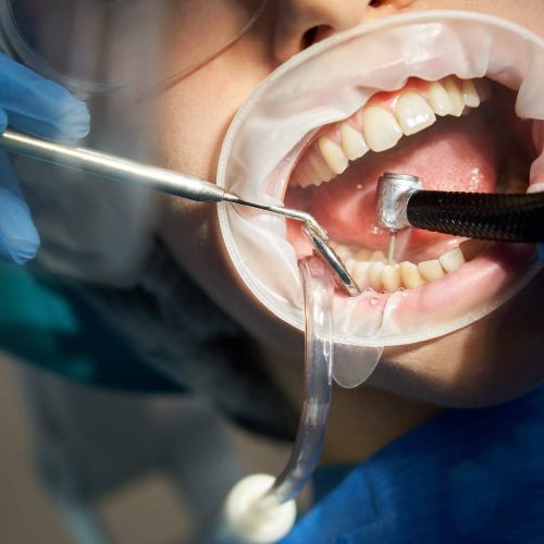 Clínica dental en Abadiño